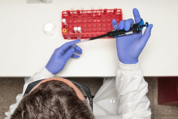 Detección del virus de la viruela símica mediante PCR en tiempo real