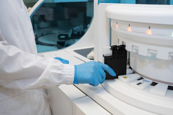 Protegido: Avances en la detección temprana del Carcinoma Hepatocelular. Utilidad del algoritmo GAAD frente a GALAD y biomarcadores individuales.