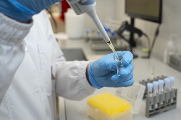 Zonulina e histamina como marcadores no invasivos del estado funcional gastrointestinal