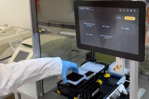 Automatización aplicada al estudio prenatal no invasivo