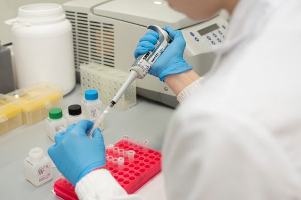 Autoanticuerpos en diabetes tipo 1: herramientas para un diagnóstico más temprano